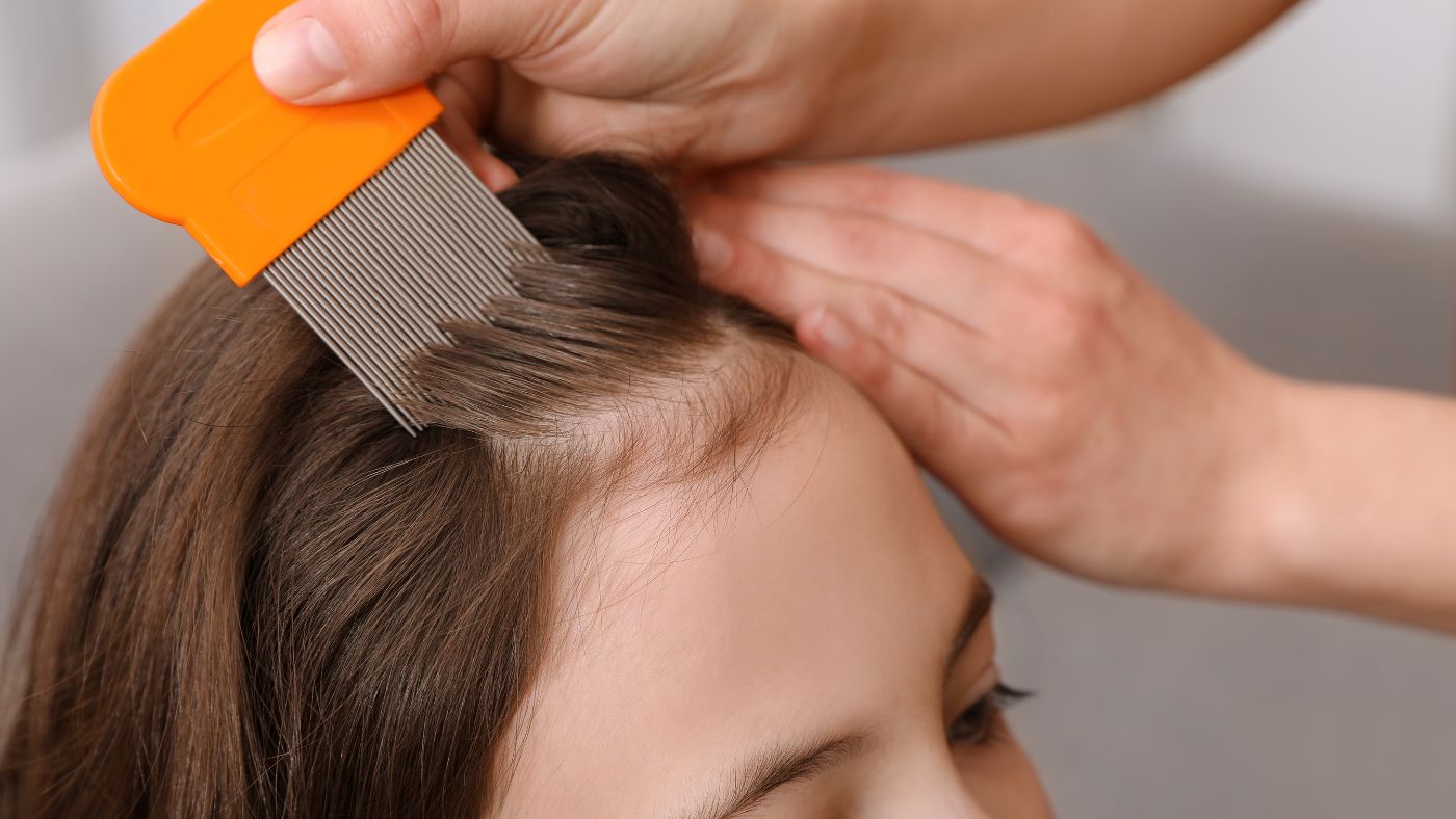 Hilangkan Kutu Rambut dengan Sisir Kutu, Efektifkah?