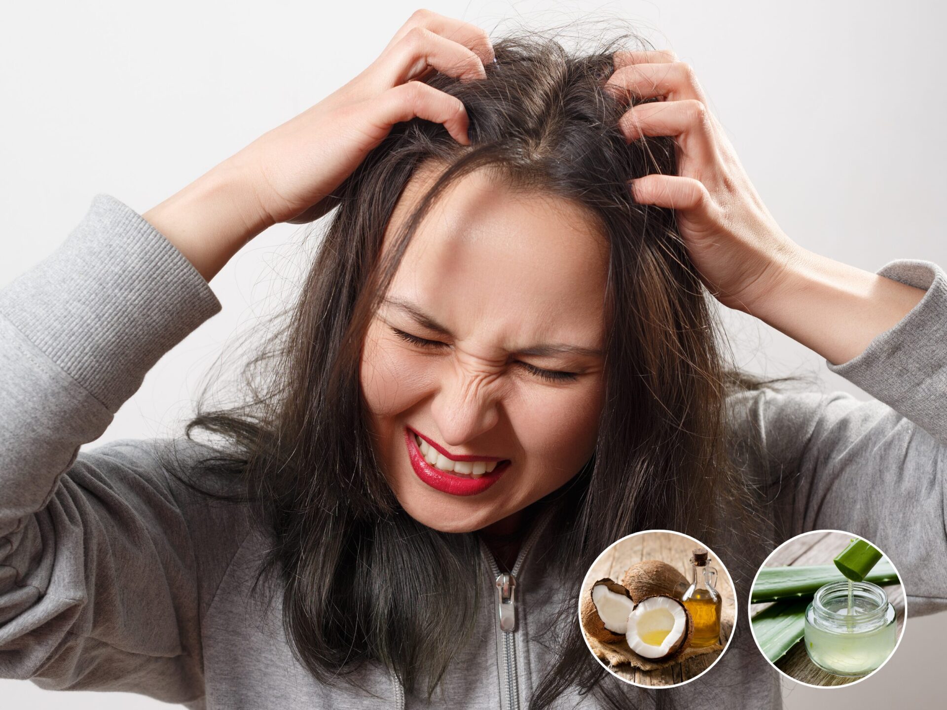 Mengatasi Rambut Gatal dengan Bahan Alami