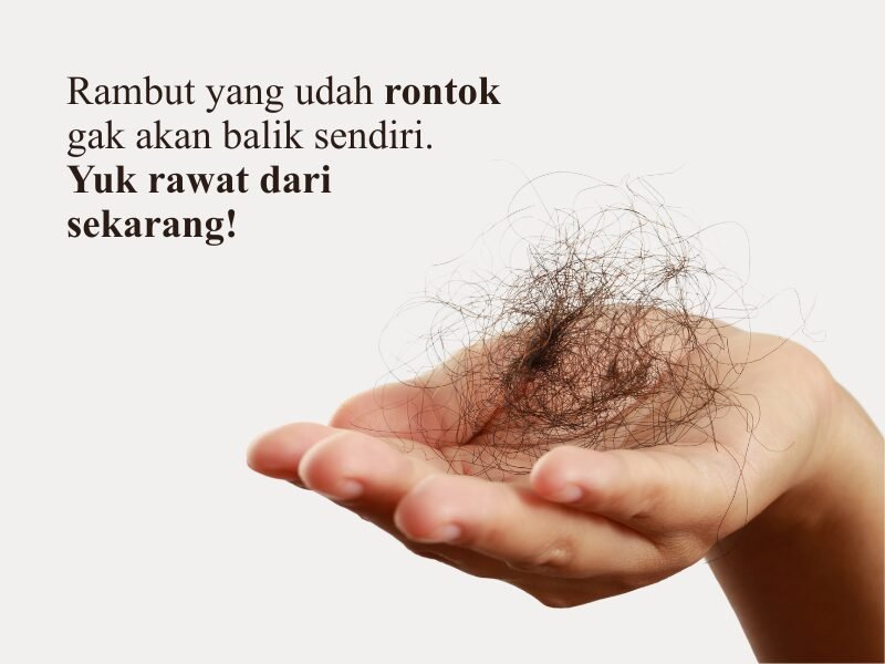 Investasi Kecil untuk Rambut yang Gak Balik Lagi